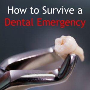 How-to-Survive-a-Dental-Emergency